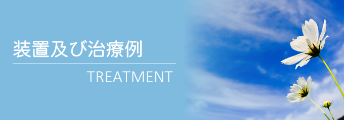 装置及び治療例
